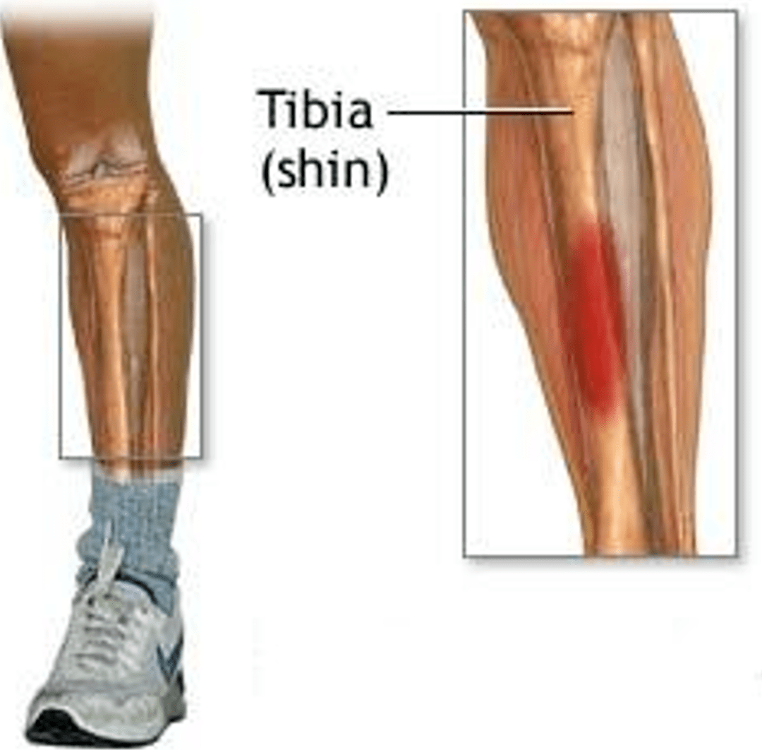 九游体育在线-儿童运动损伤报告：过度训练问题突出的简单介绍
